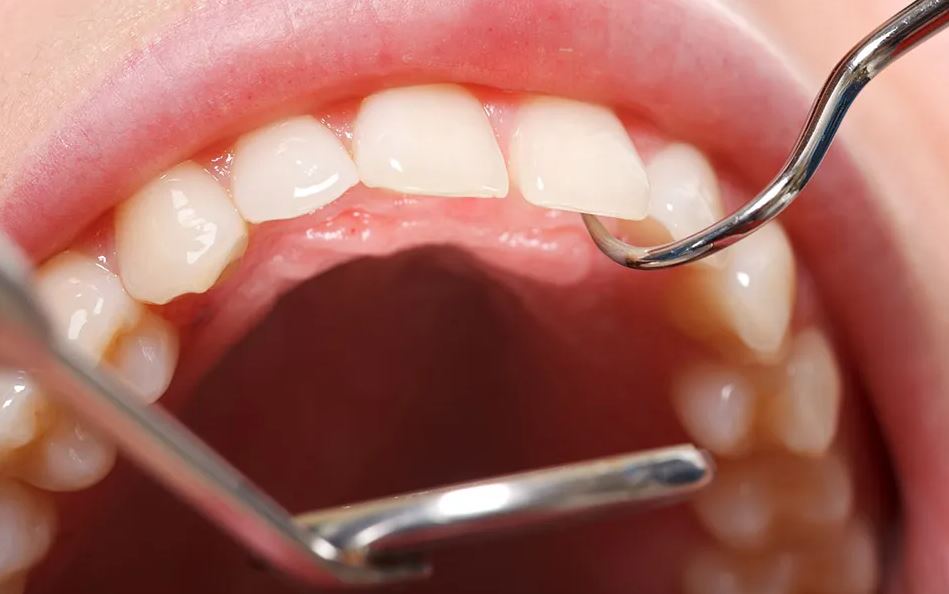 Tips to Take Better Care of Your Smile post thumbnail image