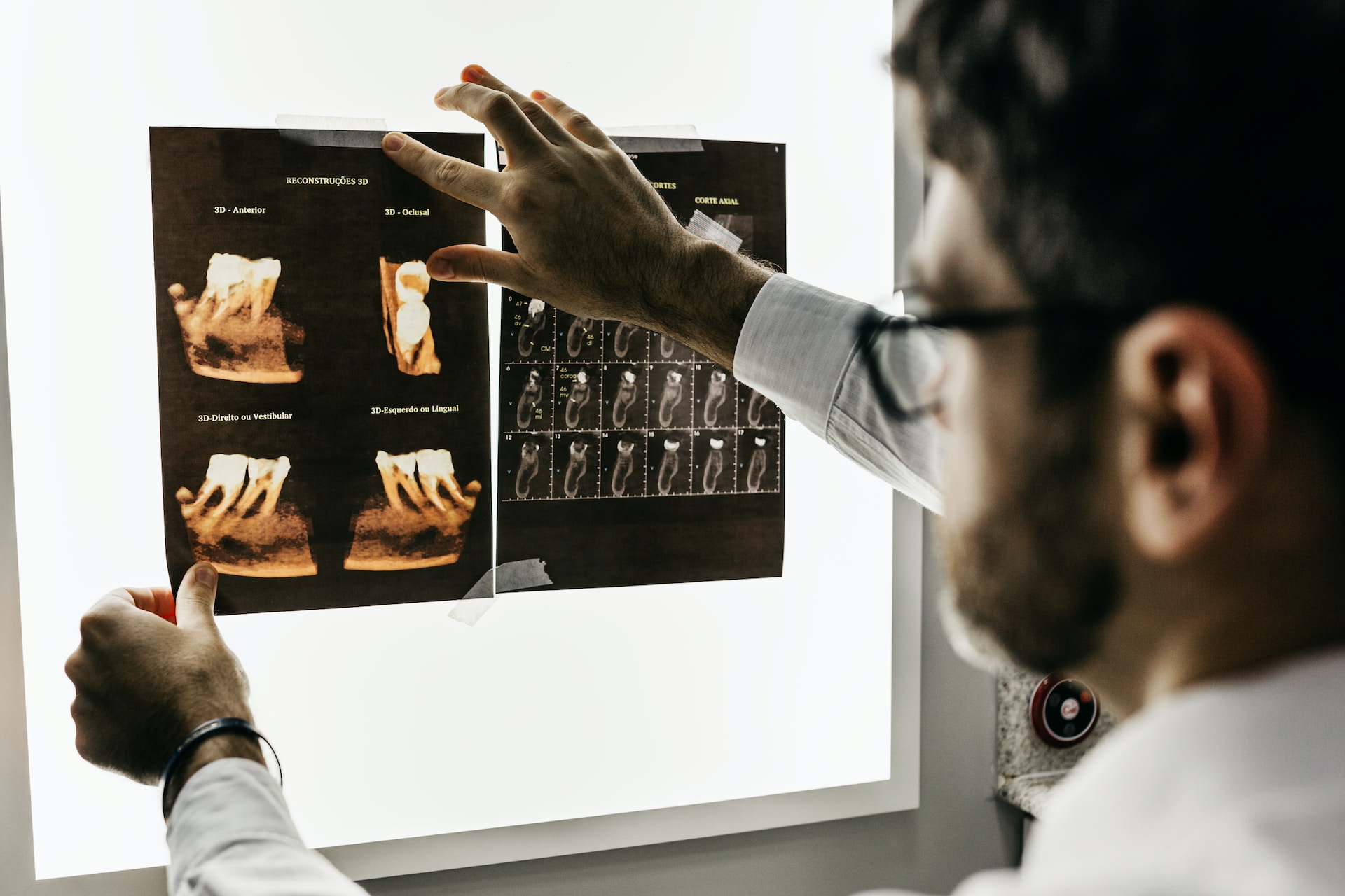 A Comprehensive Guide to Dental Health Restoration